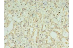 Immunohistochemistry of paraffin-embedded human adrenal gland tissue using ABIN7173203 at dilution of 1:100 (TMEM33 antibody  (AA 177-247))