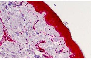 Human Skin: Formalin-Fixed, Paraffin-Embedded (FFPE) (Caspase 4 antibody)