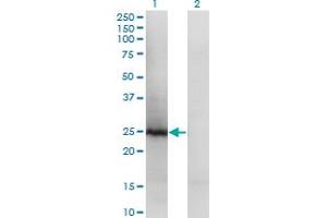 Western Blot analysis of TSN expression in transfected 293T cell line by TSN polyclonal antibody (A01). (Translin antibody  (AA 115-197))