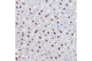 Immunohistochemistry of paraffin-embedded rat liver using PPARD Rabbit pAb (ABIN6132423, ABIN6146002, ABIN6146003 and ABIN6221300) at dilution of 1:100 (40x lens). (PPARD antibody  (AA 102-361))