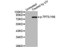 Western blot analysis of extracts from 293 cells, using Phospho-TP73-Y99 antibody. (Tumor Protein p73 antibody  (pTyr99))