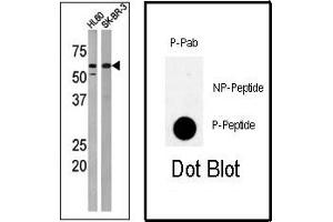 Image no. 1 for anti-Protein Kinase, Membrane Associated tyrosine/threonine 1 (PKMYT1) (pThr495) antibody (ABIN358168) (PKMYT1 antibody  (pThr495))
