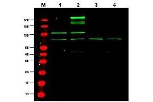Western blot using  Protein A Purified anti-RREB1 antibody shows detection of a predominant band believed to be RREB1 in various cell lysates (1 - HEK293, 2 - RFP-RREB transfected HEK293, 3 - M460 and 4 - T1165). (RREB1 antibody)