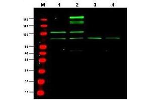 RREB1 antibody