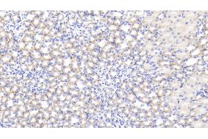 Detection of IL1RA in Mouse Kidney Tissue using Polyclonal Antibody to Interleukin 1 Receptor Antagonist (IL1RA) (IL1RN antibody  (AA 27-178))