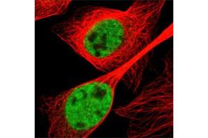 Immunofluorescent staining of human cell line U-2 OS shows positivity in nucleus but not nucleoli.