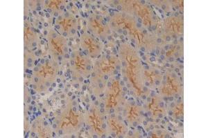 IHC-P analysis of Kidney tissue, with DAB staining. (PTPRB antibody  (AA 1214-1463))