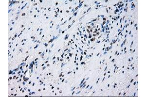 Immunohistochemical staining of paraffin-embedded liver tissue using anti-ID3mouse monoclonal antibody. (ID3 antibody)