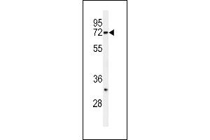Western blot analysis of HRD1 Antibody (N-term) (ABIN650702 and ABIN2839220) in SK-BR-3 cell line lysates (35 μg/lane). (SYVN1 antibody  (N-Term))