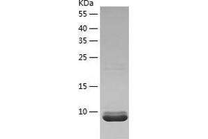 Western Blotting (WB) image for Growth Regulated Oncogene gamma (GRO gamma) (AA 35-107) protein (His tag) (ABIN7123219)