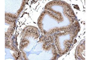 IHC-P Image DDB1 antibody detects DDB1 protein at nucleus and cytosol on mouse prostate by immunohistochemical analysis. (DDB1 antibody  (C-Term))