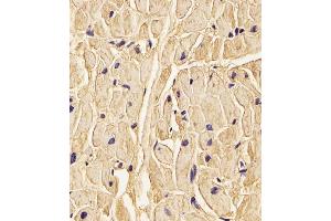(ABIN656585 and ABIN2845847) staining PLOD1 in Human heart tissue sections by Immunohistochemistry (IHC-P - paraformaldehyde-fixed, paraffin-embedded sections).
