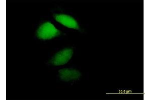 Immunofluorescence of purified MaxPab antibody to HPCA on HeLa cell. (Hippocalcin antibody  (AA 1-193))