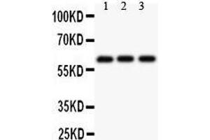 Observed bind size: 61KD (Perforin 1 antibody  (AA 175-555))