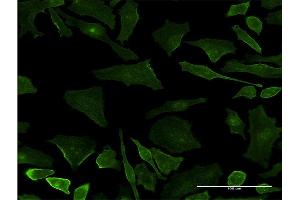 Immunofluorescence of monoclonal antibody to UBXN11 on HeLa cell. (UBXN11 antibody  (AA 311-409))