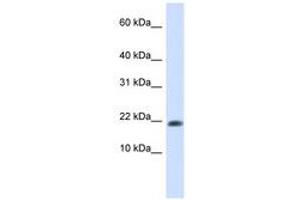 Image no. 1 for anti-GABA(A) Receptor-Associated Protein-Like 2 (GABARAPL2) (N-Term) antibody (ABIN6741130) (GABARAPL2 antibody  (N-Term))