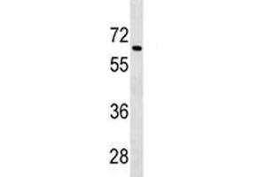Tgfbr2 antibody western blot analysis in 293 lysate. (TGFBR2 antibody  (AA 548-575))