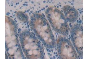 Detection of GAL2 in Rat Small intestine Tissue using Polyclonal Antibody to Galectin 2 (GAL2) (Gallinacin-2 (GAL2) (AA 1-130) antibody)