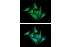 ICC/IF analysis of HPRT in HaLe cells. (HPRT1 antibody  (AA 1-218))