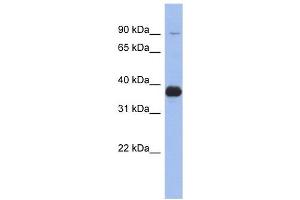 MPP3 antibody used at 1 ug/ml to detect target protein. (MPP3 antibody)