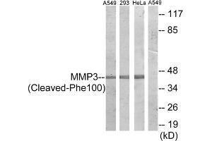 Western blot analysis of extracts from A549 cells and HeLa cells treated with etoposide (25uM, 24hours), 293 cells treated with etoposide (25uM, 1hour), using MMP3 (Cleaved-Phe100) antibody. (MMP3 antibody  (Cleaved-Phe100))