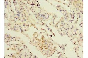 Immunohistochemistry of paraffin-embedded human lung tissue using ABIN7166622 at dilution of 1:100