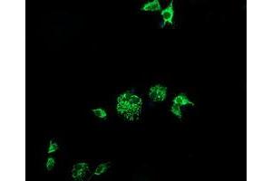 Image no. 3 for anti-Cytidine Monophosphate (UMP-CMP) Kinase 1, Cytosolic (CMPK1) antibody (ABIN1497544) (Cytidine Monophosphate (UMP-CMP) Kinase 1, Cytosolic (CMPK1) antibody)