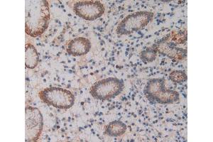 Used in DAB staining on fromalin fixed paraffin- embedded stomach tissue (SIRPB1 antibody  (AA 127-356))