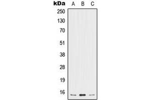 Western blot analysis of IL-5 expression in MCF7 (A), SP2/0 (B), H9C2 (C) whole cell lysates.