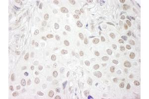 anti-CD3e Molecule, epsilon Associated Protein (CD3EAP) (AA 404-454) antibody