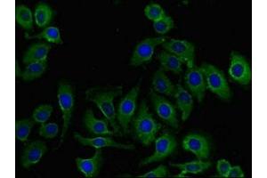 Immunofluorescent analysis of A549 cells using ABIN7168038 at dilution of 1:100 and Alexa Fluor 488-congugated AffiniPure Goat Anti-Rabbit IgG(H+L) (RHOH antibody  (AA 1-188))