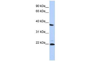 PSMB2 antibody used at 1 ug/ml to detect target protein. (PSMB2 antibody)
