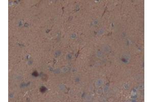 Used in DAB staining on fromalin fixed paraffin- embedded brain tissue (Thrombospondin 1 antibody  (AA 71-259))