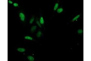 Image no. 4 for anti-Cyclin-Dependent Kinase 2 (CDK2) antibody (ABIN1497394) (CDK2 antibody)