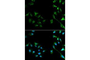 Immunofluorescence analysis of A549 cell using ERK1/2 antibody. (ERK2 antibody  (AA 200-300))