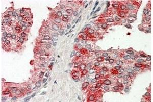 AP20162PU-N ACPP Antibody staining of paraffin embedded Human Prostate at 3. (ACPP antibody  (Internal Region))