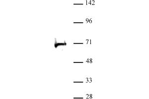 RBBP5 antibody (pAb) tested by Western blot. (RBBP5 antibody  (C-Term))