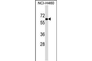 Western blot analysis in NCI-H460 cell line lysates (35ug/lane). (UGT2B11 antibody  (C-Term))