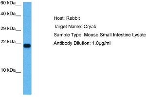 Host: Mouse Target Name: CRYAB Sample Tissue: Mouse Small Intestine Antibody Dilution: 1ug/ml (CRYAB antibody  (N-Term))