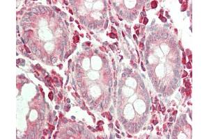 Human Colon: Formalin-Fixed, Paraffin-Embedded (FFPE). (ERGIC3 antibody  (HRP))