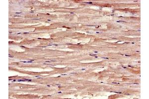 Immunohistochemistry of paraffin-embedded human skeletal muscle tissue using ABIN7171205 at dilution of 1:100