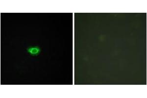 Immunofluorescence analysis of HuvEc cells, using GPR108 Antibody. (GPR108 antibody  (AA 155-204))