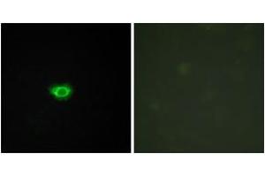 Immunofluorescence analysis of HuvEc cells, using GPR108 Antibody. (GPR108 antibody  (AA 155-204))