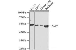 Western blot analysis of extracts of various cell lines using ACPP Polyclonal Antibody at dilution of 1:1000. (ACPP antibody)