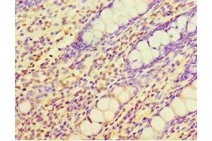 Immunohistochemistry of paraffin-embedded human colon tissue using ABIN7147558 at dilution of 1:100 (CHI3L2 antibody  (AA 27-390))