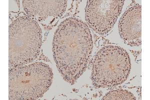 ABIN6267554 at 1/100 staining rat testicular tissue sections by IHC-P.