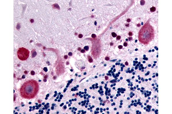 GPR32 antibody  (Cytoplasmic Domain)
