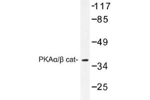 Image no. 1 for anti-Protein Kinase A, alpha (PRKACA) antibody (ABIN317665) (PRKACA antibody)