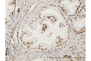 Immunoperoxidase of monoclonal antibody to LMO4 on formalin-fixed paraffin-embedded human prostate. (LMO4 antibody  (AA 1-165))