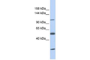 SLC39A10 antibody used at 1 ug/ml to detect target protein. (SLC39A10 antibody)